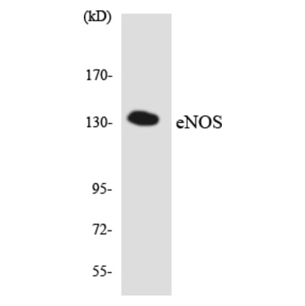 Western Blot - Anti-eNOS Antibody (R12-2751) - Antibodies.com
