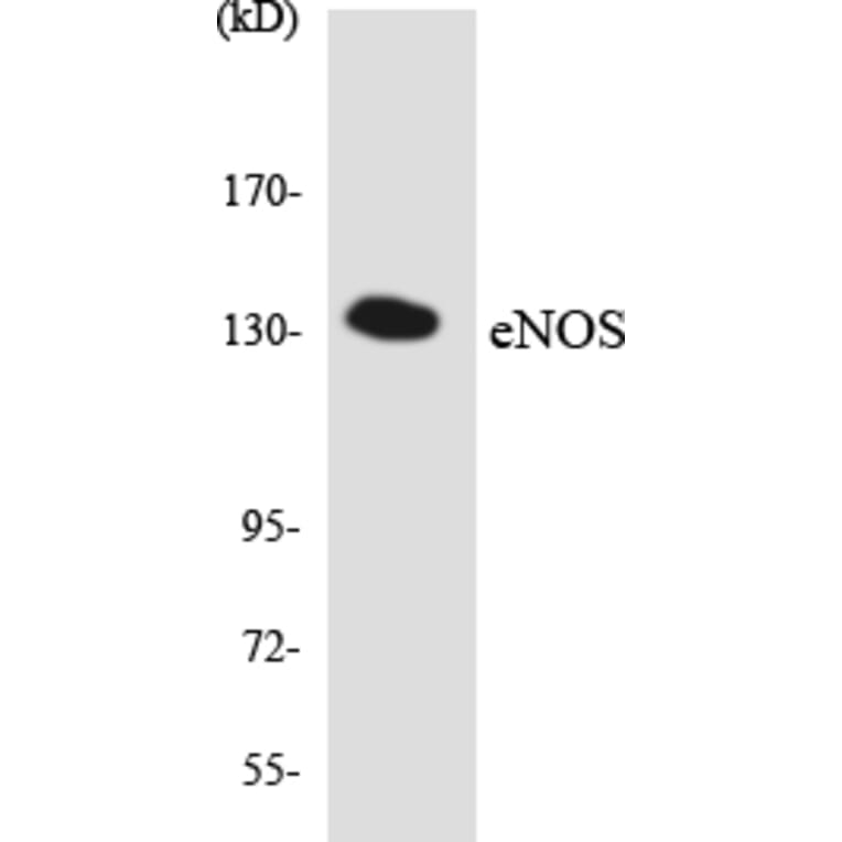 Western Blot - Anti-eNOS Antibody (R12-2751) - Antibodies.com