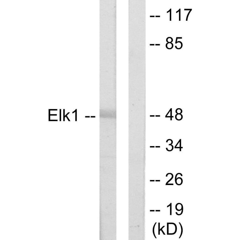 Western Blot - Anti-Elk1 Antibody (C10425) - Antibodies.com