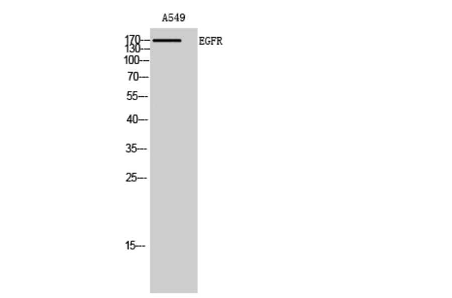 Western Blot - Anti-EGFR Antibody (C10257) - Antibodies.com