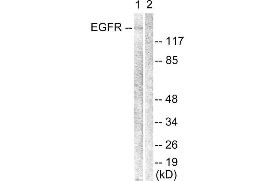 Western Blot - Anti-EGFR Antibody (B0912) - Antibodies.com