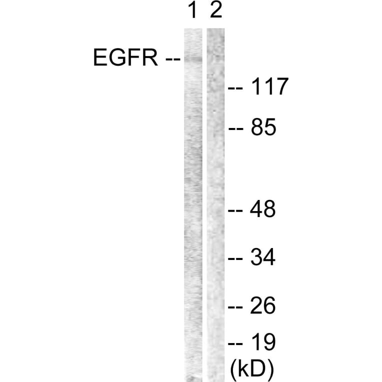 Western Blot - Anti-EGFR Antibody (B0912) - Antibodies.com