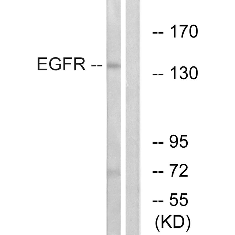 Western Blot - Anti-EGFR Antibody (B7064) - Antibodies.com