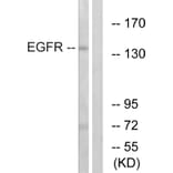 Western Blot - Anti-EGFR Antibody (B7064) - Antibodies.com