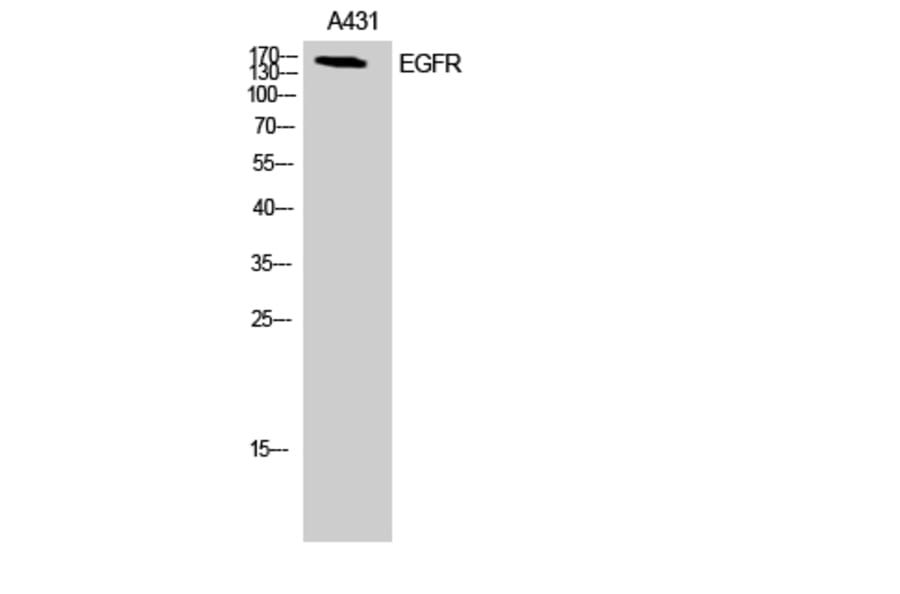 Western Blot - Anti-EGFR Antibody (B7064) - Antibodies.com