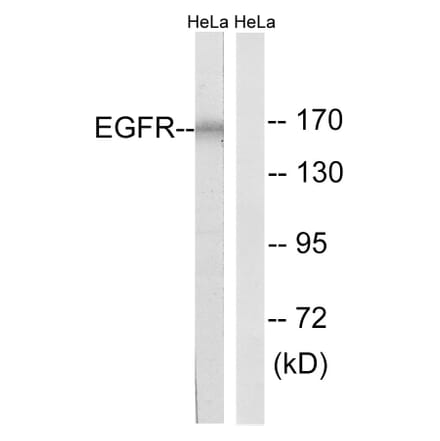 Western Blot - Anti-EGFR Antibody (B8024) - Antibodies.com