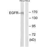 Western Blot - Anti-EGFR Antibody (B8024) - Antibodies.com