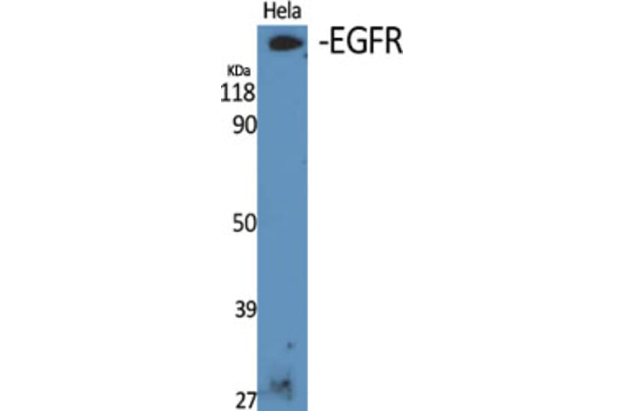 Western Blot - Anti-EGFR Antibody (B8024) - Antibodies.com