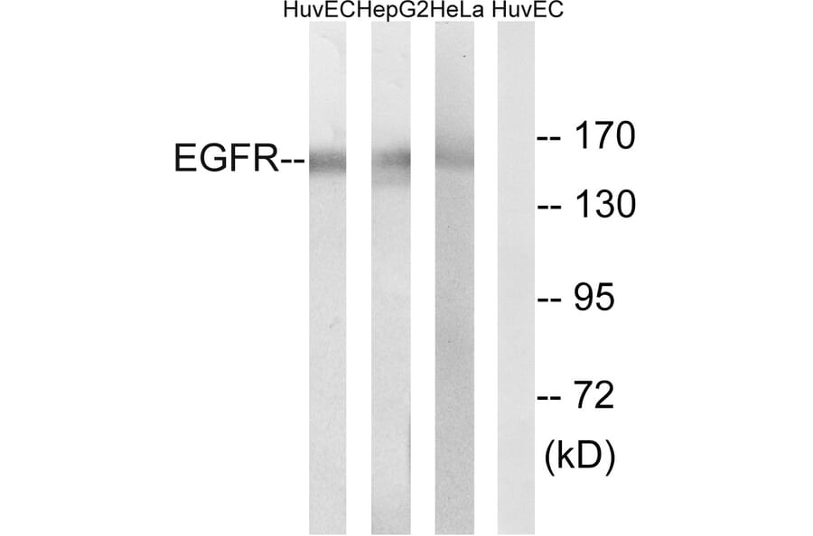 Western Blot - Anti-EGFR Antibody (B8025) - Antibodies.com