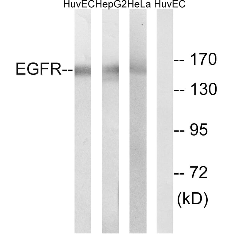Western Blot - Anti-EGFR Antibody (B8025) - Antibodies.com