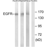 Western Blot - Anti-EGFR Antibody (B8025) - Antibodies.com