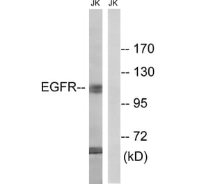 Western Blot - Anti-EGFR Antibody (B8026) - Antibodies.com