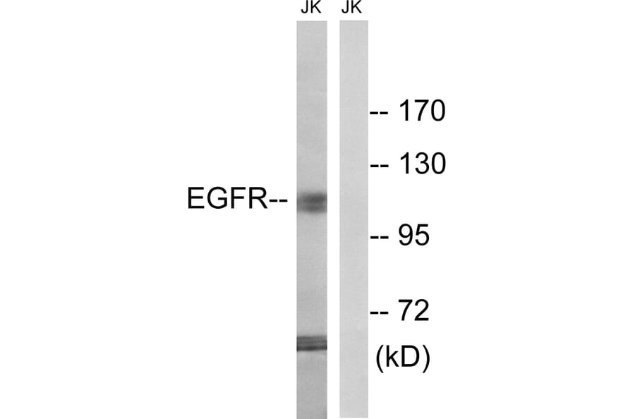 Western Blot - Anti-EGFR Antibody (B8026) - Antibodies.com