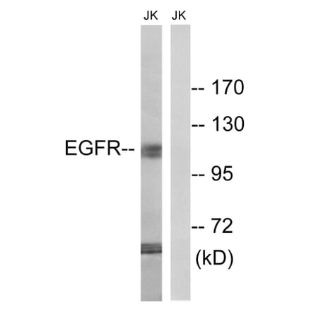 Western Blot - Anti-EGFR Antibody (B8026) - Antibodies.com