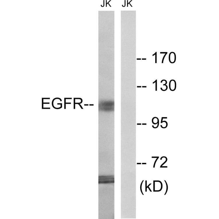 Western Blot - Anti-EGFR Antibody (B8026) - Antibodies.com