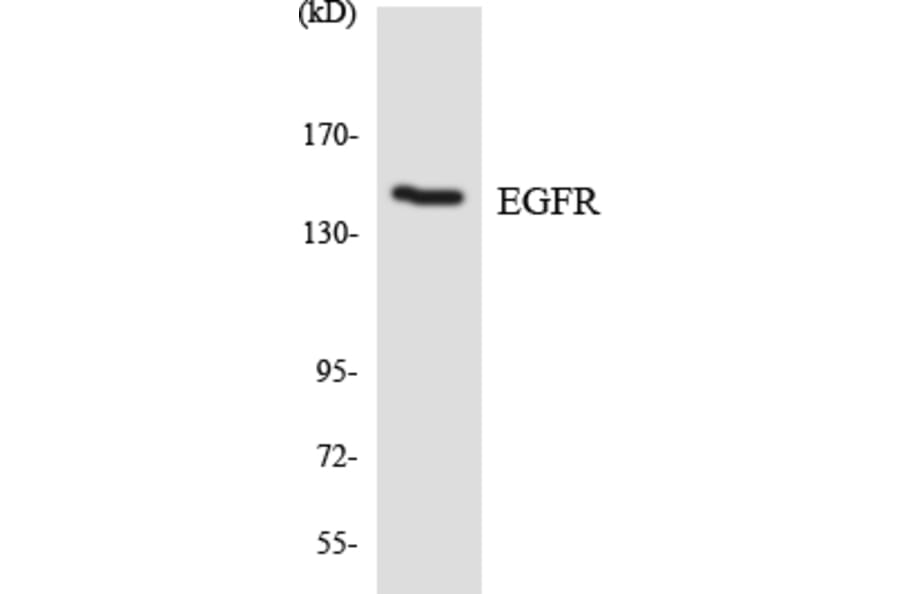 Western Blot - Anti-EGFR Antibody (R12-2733) - Antibodies.com