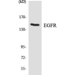 Western Blot - Anti-EGFR Antibody (R12-2733) - Antibodies.com