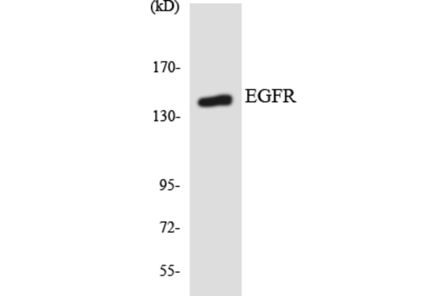 Western Blot - Anti-EGFR Antibody (R12-2735) - Antibodies.com
