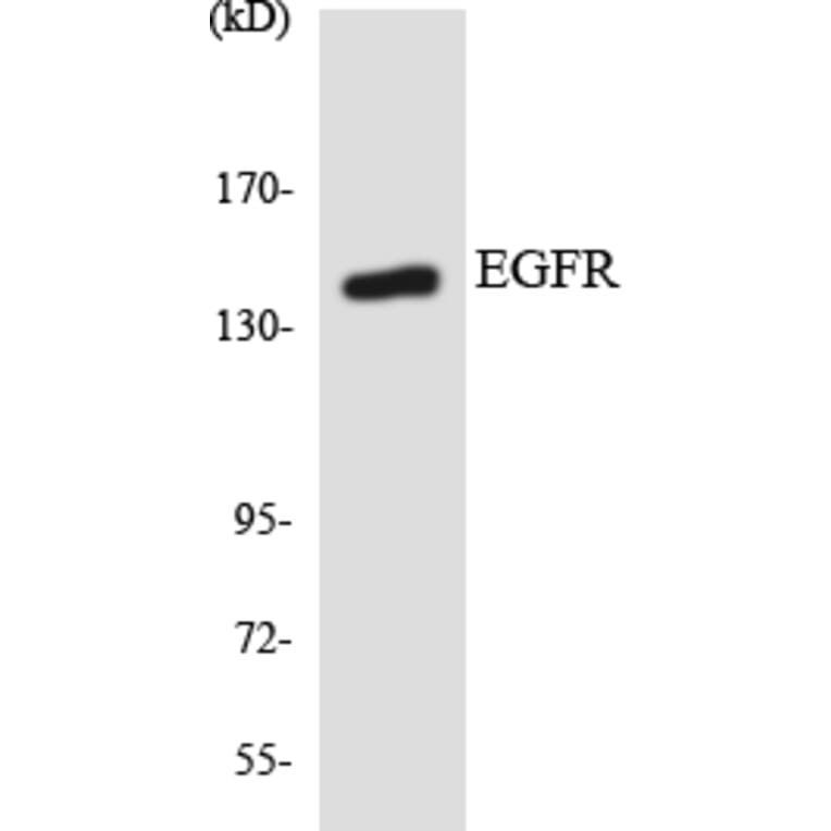 Western Blot - Anti-EGFR Antibody (R12-2735) - Antibodies.com