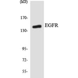 Western Blot - Anti-EGFR Antibody (R12-2735) - Antibodies.com