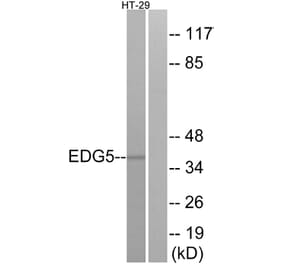 Western Blot - Anti-EDG5 Antibody (G237) - Antibodies.com
