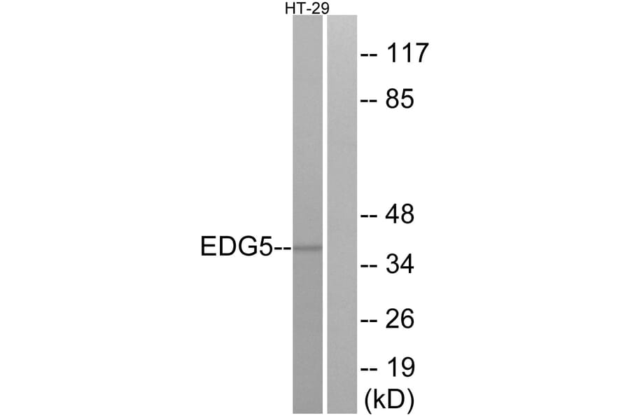 Western Blot - Anti-EDG5 Antibody (G237) - Antibodies.com