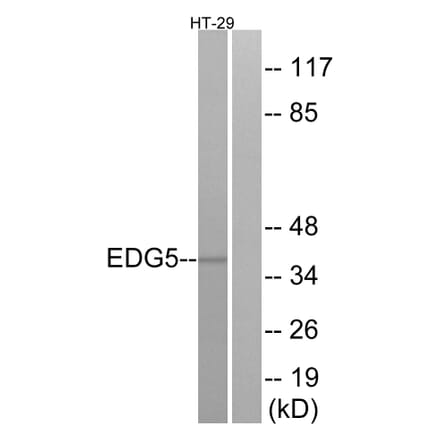 Western Blot - Anti-EDG5 Antibody (G237) - Antibodies.com