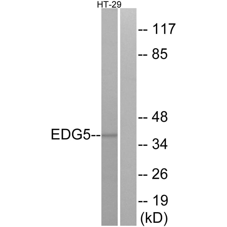 Western Blot - Anti-EDG5 Antibody (G237) - Antibodies.com