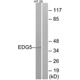 Western Blot - Anti-EDG5 Antibody (G237) - Antibodies.com