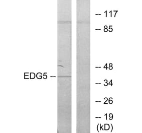 Western Blot - Anti-EDG5 Antibody (G086) - Antibodies.com