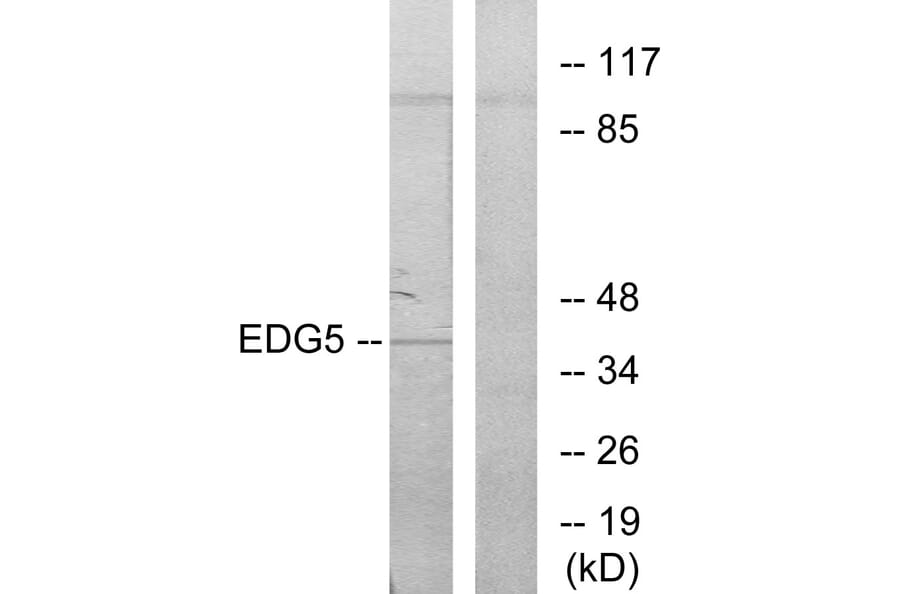 Western Blot - Anti-EDG5 Antibody (G086) - Antibodies.com