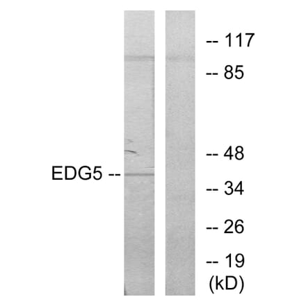 Western Blot - Anti-EDG5 Antibody (G086) - Antibodies.com