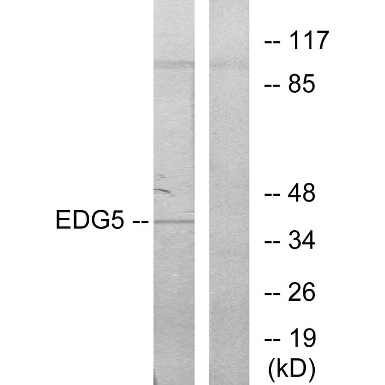 Western Blot - Anti-EDG5 Antibody (G086) - Antibodies.com