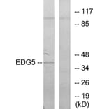 Western Blot - Anti-EDG5 Antibody (G086) - Antibodies.com