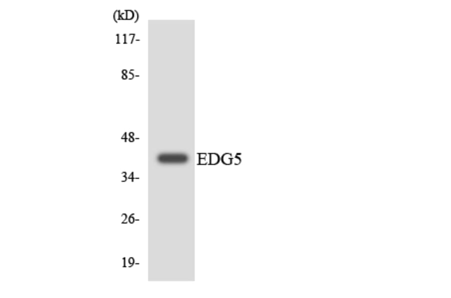 Western Blot - Anti-EDG5 Antibody (R12-2725) - Antibodies.com