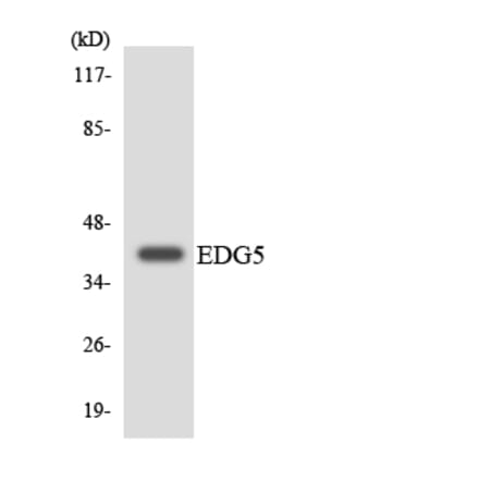 Western Blot - Anti-EDG5 Antibody (R12-2725) - Antibodies.com