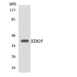 Western Blot - Anti-EDG5 Antibody (R12-2725) - Antibodies.com
