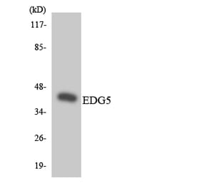 Western Blot - Anti-EDG5 Antibody (R12-2726) - Antibodies.com
