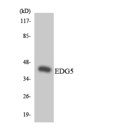 Western Blot - Anti-EDG5 Antibody (R12-2726) - Antibodies.com