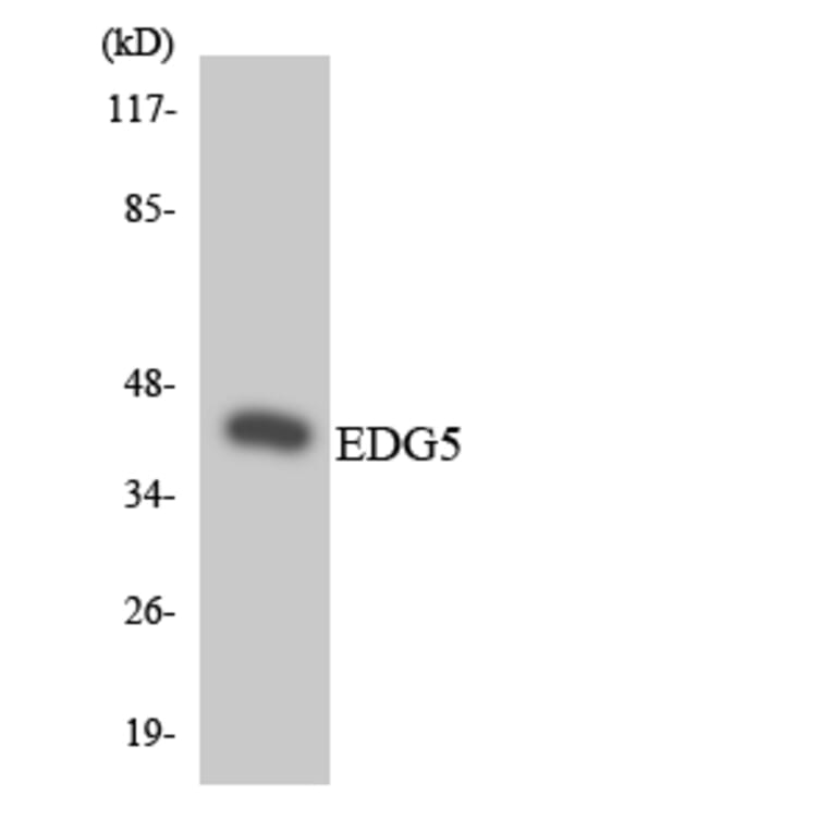 Western Blot - Anti-EDG5 Antibody (R12-2726) - Antibodies.com