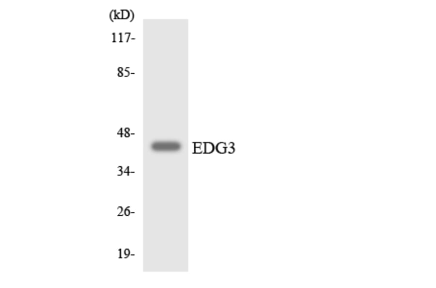 Western Blot - Anti-EDG3 Antibody (R12-2722) - Antibodies.com