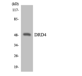 Western Blot - Anti-DRD4 Antibody (R12-2713) - Antibodies.com