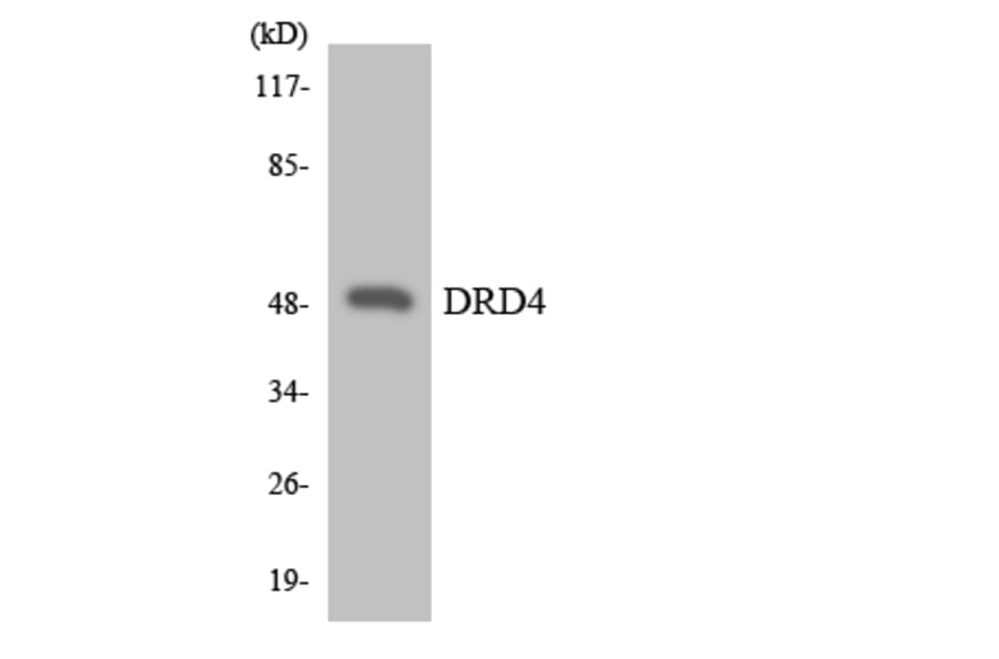 Western Blot - Anti-DRD4 Antibody (R12-2713) - Antibodies.com