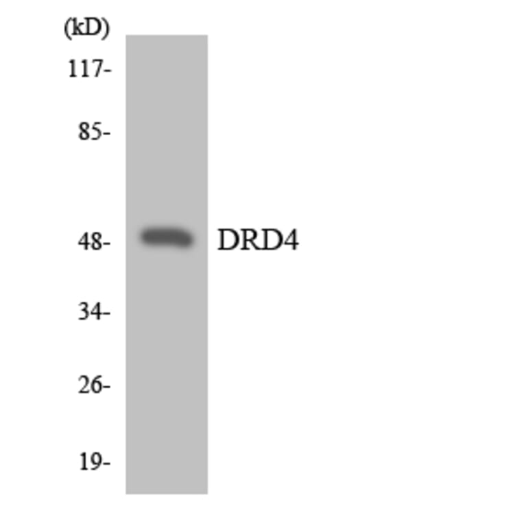 Western Blot - Anti-DRD4 Antibody (R12-2713) - Antibodies.com