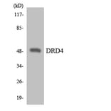 Western Blot - Anti-DRD4 Antibody (R12-2713) - Antibodies.com