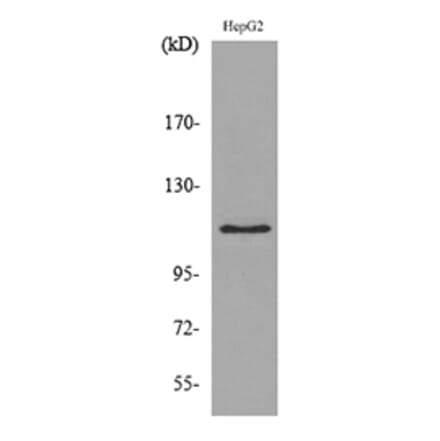 Western Blot - Anti-DPYD Antibody (C30284) - Antibodies.com