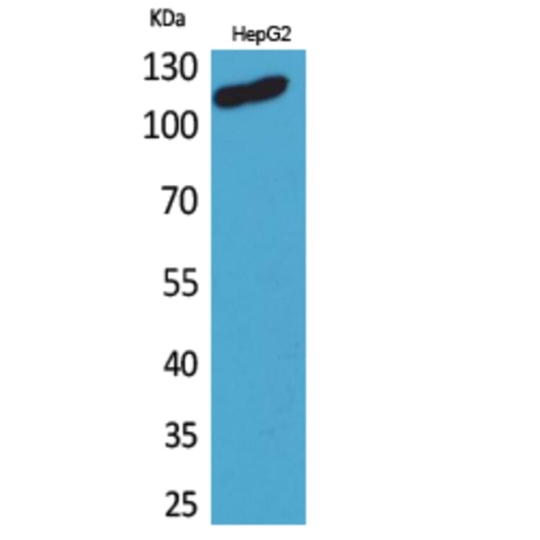 Western Blot - Anti-DPYD Antibody (C30284) - Antibodies.com
