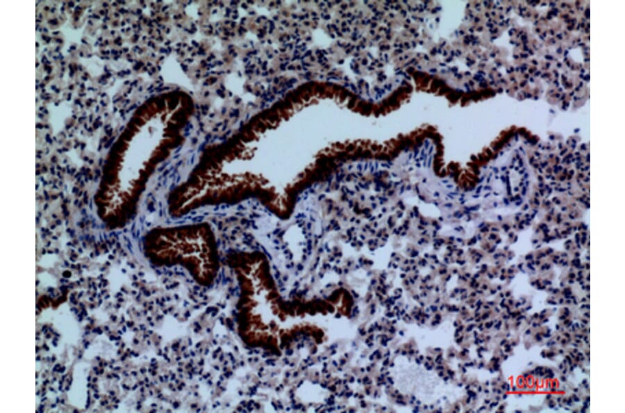 Immunohistochemistry - Anti-DPYD Antibody (C30284) - Antibodies.com