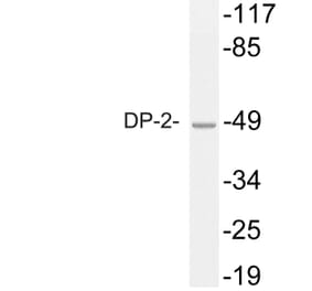 Western Blot - Anti-DP-2 Antibody (R12-2118) - Antibodies.com