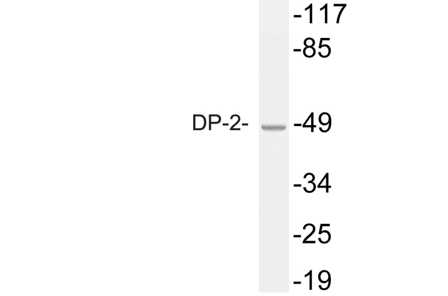 Western Blot - Anti-DP-2 Antibody (R12-2118) - Antibodies.com